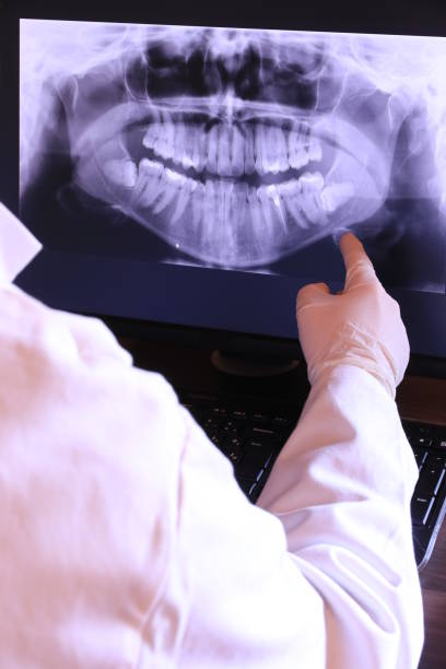 Best Emergency Treatment for Oral Infections in Columbus, KS