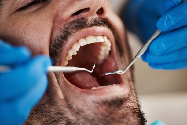 Best Emergency Cosmetic Dentistry (e.g., broken veneers) in Columbus, KS